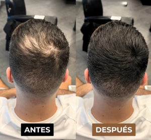 BUNNE FX® – Efecto Cabello Instantáneo unisex