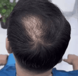 BUNNE FX® – Efecto Cabello Instantáneo unisex