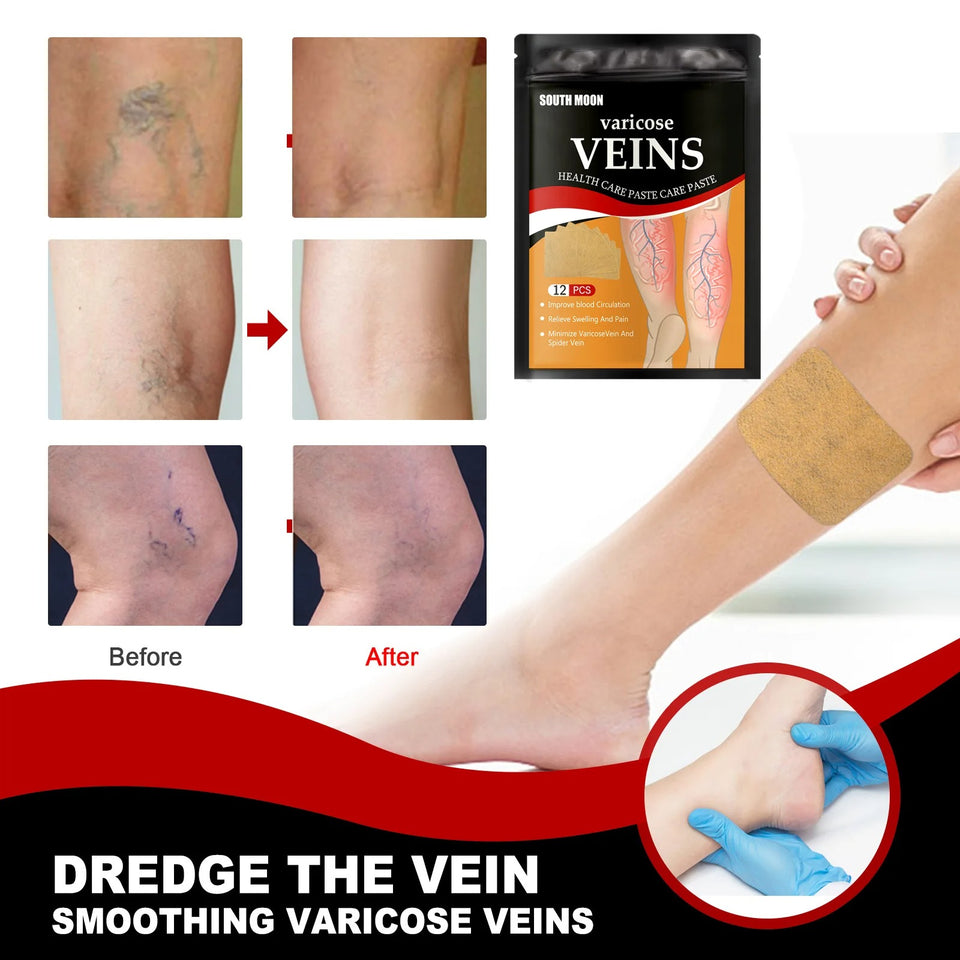 VenoMax® Parches para unas piernas más ligeras ¡OFERTA!🔥